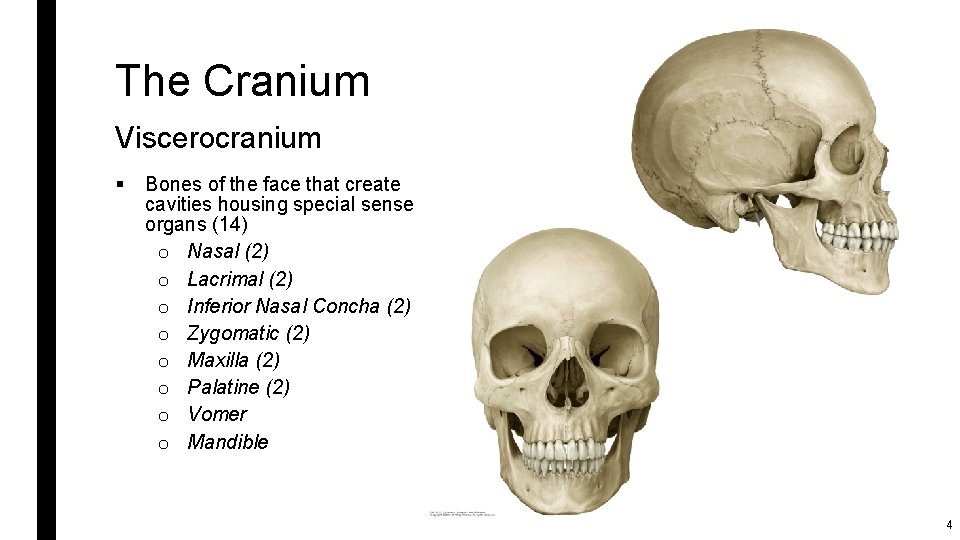 The Cranium Viscerocranium § Bones of the face that create cavities housing special sense