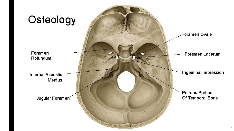Osteology Foramen Ovale Foramen Rotundum Internal Acoustic Meatus Jugular Foramen Lacerum Trigeminal Impression Petrous