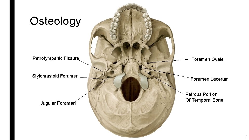 Osteology Petrotympanic Fissure Stylomastoid Foramen Jugular Foramen Ovale Foramen Lacerum Petrous Portion Of Temporal