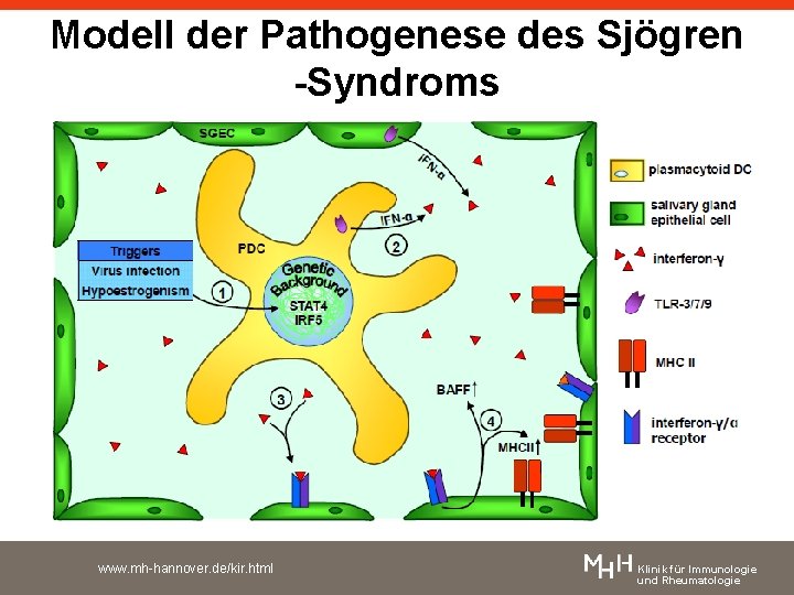 Modell der Pathogenese des Sjögren -Syndroms www. mh-hannover. de/kir. html Klinik für Immunologie und