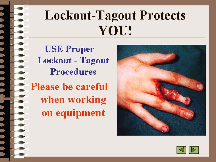 Lockout-Tagout Protects YOU! USE Proper Lockout - Tagout Procedures Please be careful when working