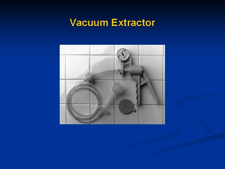 Vacuum Extractor Vacuum Extractor