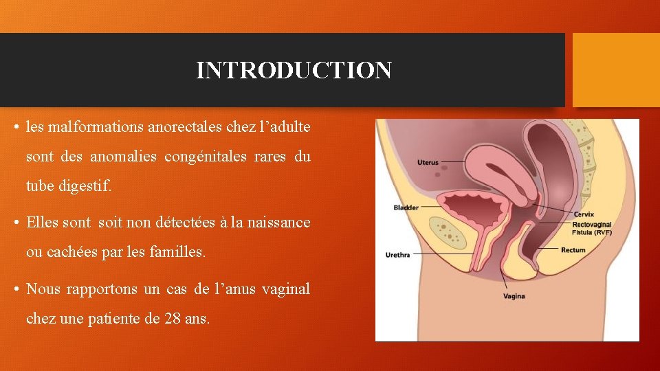 INTRODUCTION • les malformations anorectales chez l’adulte sont des anomalies congénitales rares du tube