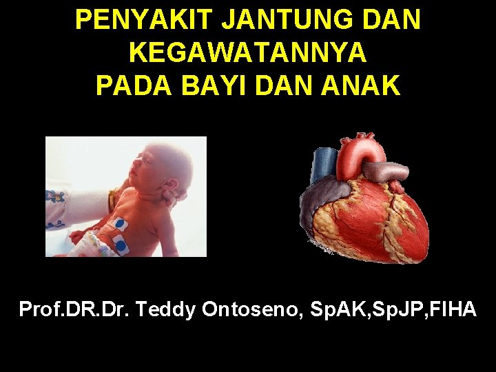 PENYAKIT JANTUNG DAN KEGAWATANNYA PADA BAYI DAN ANAK Prof. DR. Dr. Teddy Ontoseno, Sp.