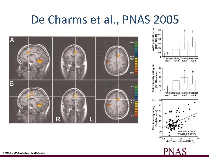De Charms et al. , PNAS 2005 © 2005 by National Academy of Sciences
