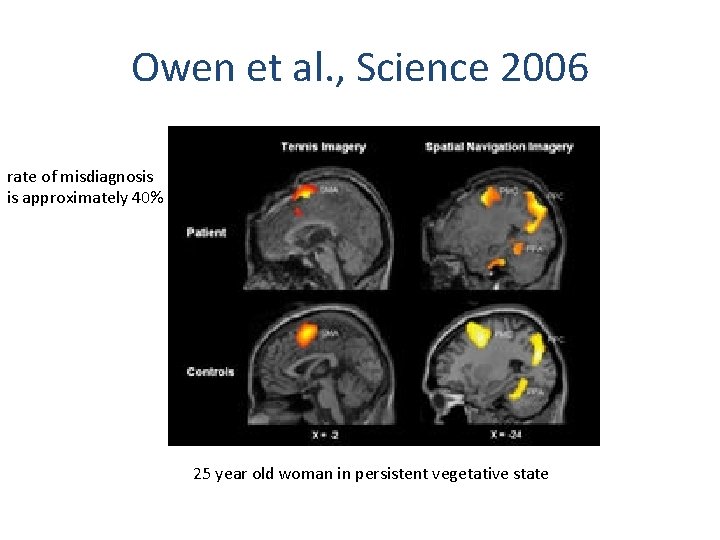Owen et al. , Science 2006 rate of misdiagnosis is approximately 40% 25 year