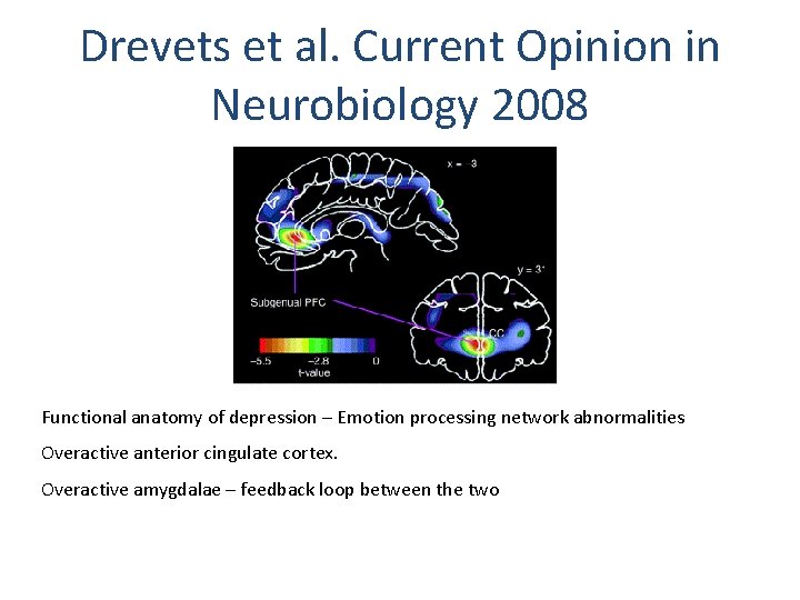 Drevets et al. Current Opinion in Neurobiology 2008 Functional anatomy of depression – Emotion