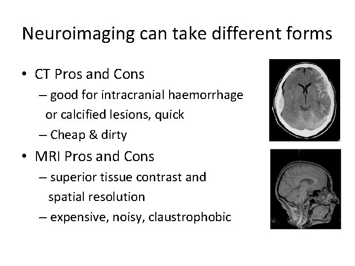Neuroimaging can take different forms • CT Pros and Cons – good for intracranial
