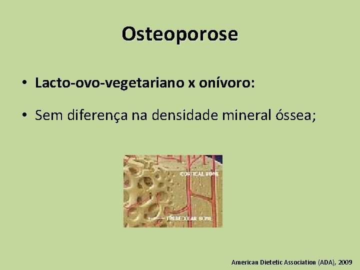 Osteoporose • Lacto-ovo-vegetariano x onívoro: • Sem diferença na densidade mineral óssea; American Dietetic