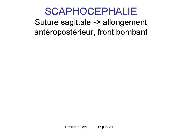 SCAPHOCEPHALIE Suture sagittale -> allongement antéropostérieur, front bombant Pédiatrie Creil 15 juin 2010 SCAPHOCEPHALIE Suture sagittale -> allongement antéropostérieur, front bombant Pédiatrie Creil 15 juin 2010