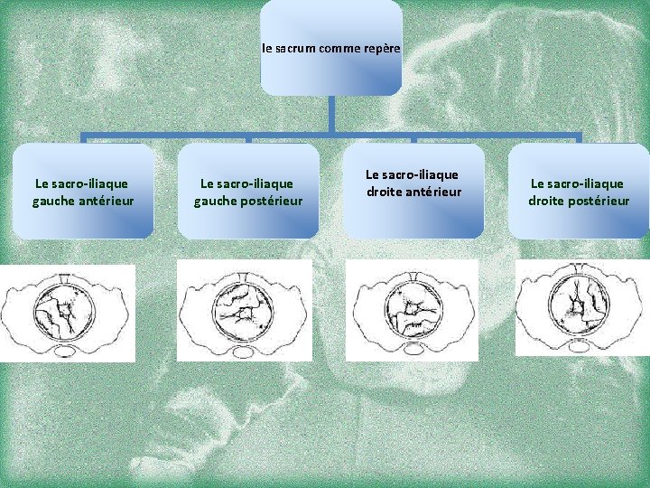 le sacrum comme repère Le sacro-iliaque gauche antérieur Le sacro-iliaque gauche postérieur Le sacro-iliaque