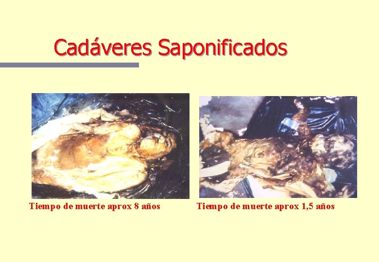 Cadáveres Saponificados Tiempo de muerte aprox 8 años Tiempo de muerte aprox 1, 5 Cadáveres Saponificados Tiempo de muerte aprox 8 años Tiempo de muerte aprox 1, 5
