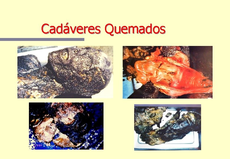 Cadáveres Quemados Cadáveres Quemados