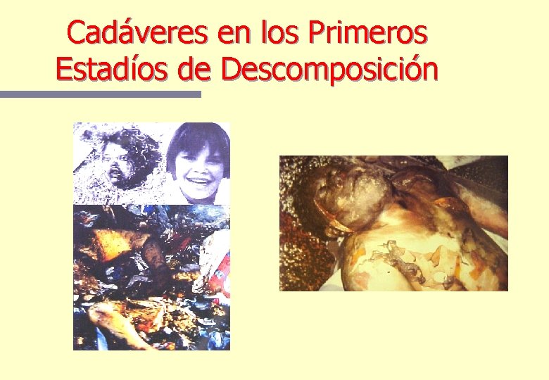 Cadáveres en los Primeros Estadíos de Descomposición Cadáveres en los Primeros Estadíos de Descomposición