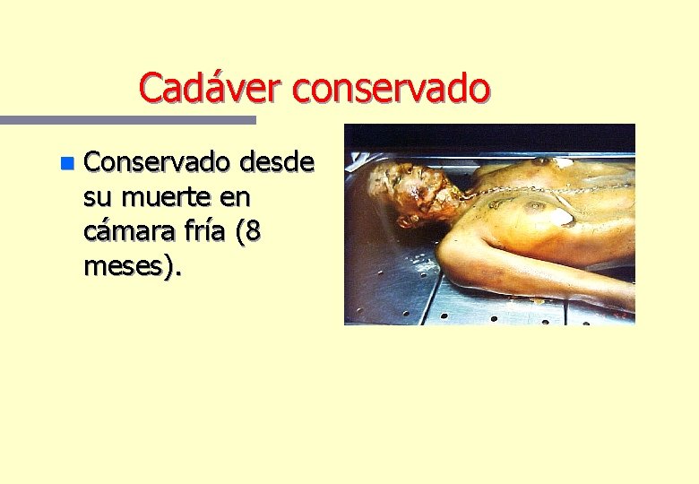 Cadáver conservado n Conservado desde su muerte en cámara fría (8 meses). Cadáver conservado n Conservado desde su muerte en cámara fría (8 meses).