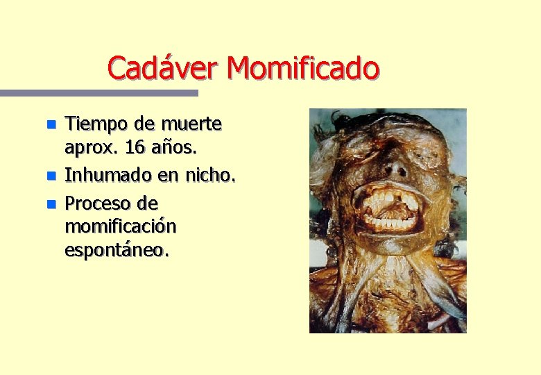 Cadáver Momificado n n n Tiempo de muerte aprox. 16 años. Inhumado en nicho. Cadáver Momificado n n n Tiempo de muerte aprox. 16 años. Inhumado en nicho.