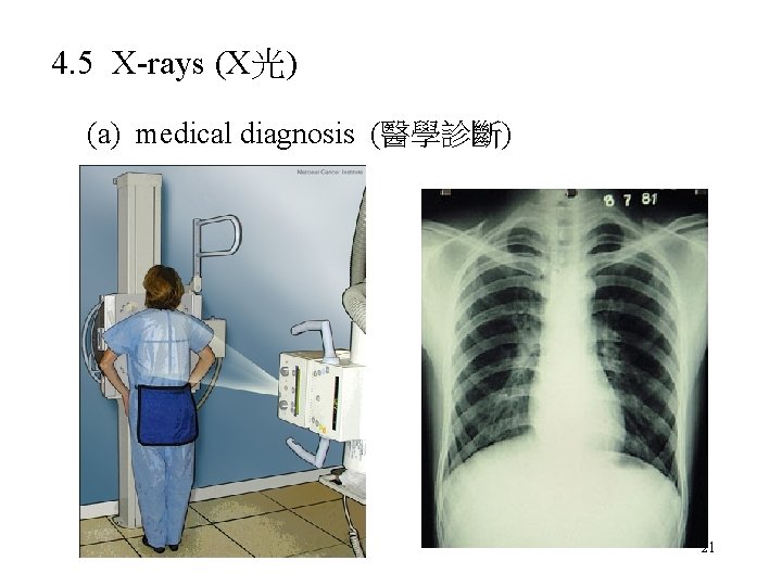 4. 5 X-rays (X光) (a) medical diagnosis (醫學診斷) 21 