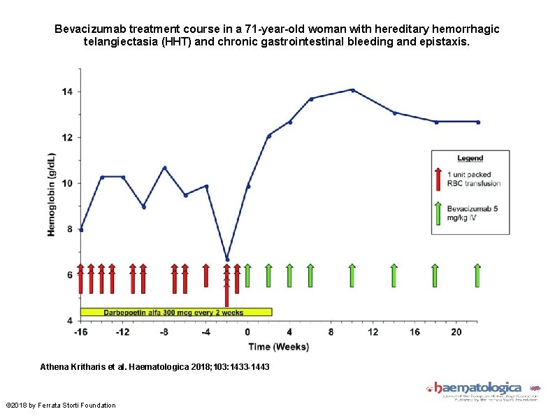 Bevacizumab treatment course in a 71 -year-old woman with hereditary hemorrhagic telangiectasia (HHT) and