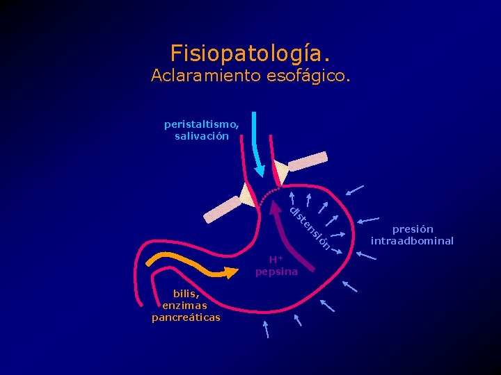 Fisiopatología. Aclaramiento esofágico. peristaltismo, salivación ón si en st di H+ pepsina bilis, enzimas