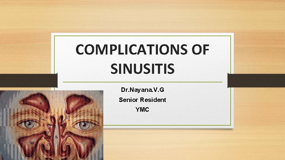 COMPLICATIONS OF SINUSITIS Dr. Nayana. V. G Senior Resident YMC 