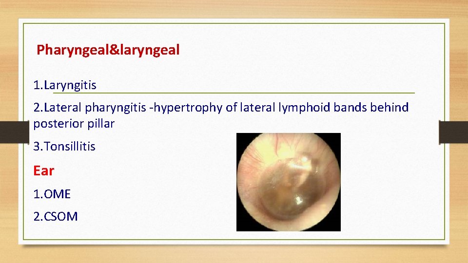 Pharyngeal&laryngeal 1. Laryngitis 2. Lateral pharyngitis -hypertrophy of lateral lymphoid bands behind posterior pillar