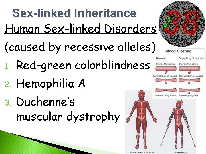 Sex-linked Inheritance Human Sex-linked Disorders (caused by recessive alleles) 1. Red-green colorblindness 2. Hemophilia