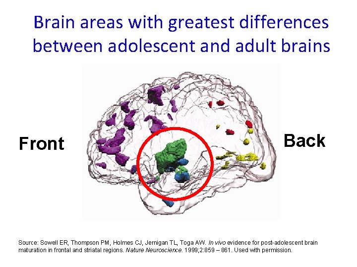 Brain areas with greatest differences between adolescent and adult brains Front Back Source: Sowell Brain areas with greatest differences between adolescent and adult brains Front Back Source: Sowell