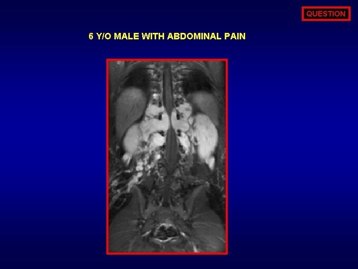 QUESTION 6 Y/O MALE WITH ABDOMINAL PAIN 
