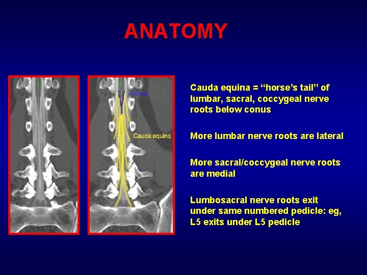 ANATOMY Cauda equina = “horse’s tail” of lumbar, sacral, coccygeal nerve roots below conus