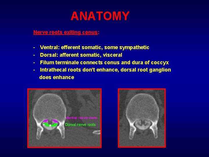 ANATOMY Nerve roots exiting conus: - Ventral: efferent somatic, some sympathetic Dorsal: afferent somatic,