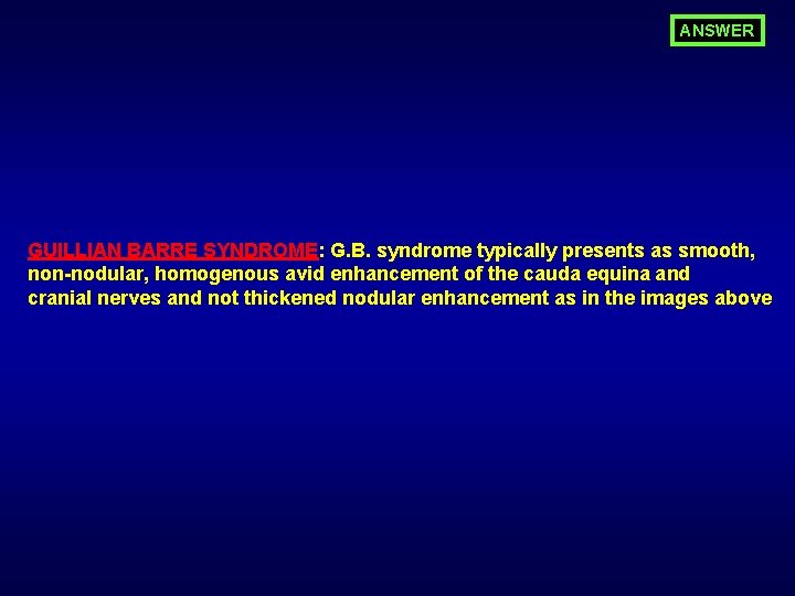 ANSWER GUILLIAN BARRE SYNDROME: G. B. syndrome typically presents as smooth, non-nodular, homogenous avid