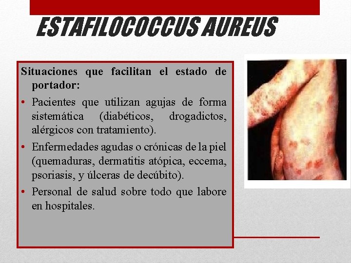 ESTAFILOCOCCUS AUREUS Situaciones que facilitan el estado de portador: • Pacientes que utilizan agujas