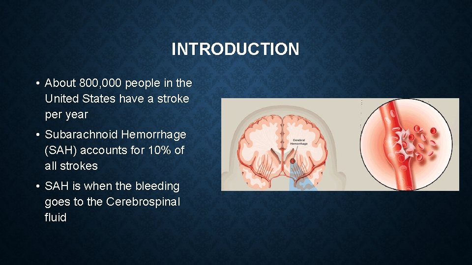 INTRODUCTION • About 800, 000 people in the United States have a stroke per