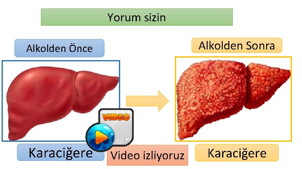 Yorum sizin Alkolden Sonra Alkolden Önce Karaciğere Video izliyoruz Karaciğere 