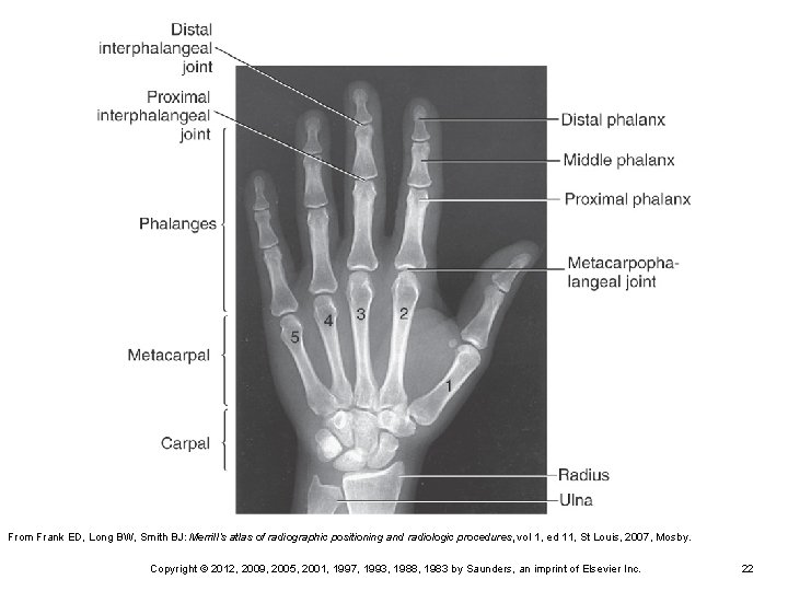 From Frank ED, Long BW, Smith BJ: Merrill’s atlas of radiographic positioning and radiologic From Frank ED, Long BW, Smith BJ: Merrill’s atlas of radiographic positioning and radiologic