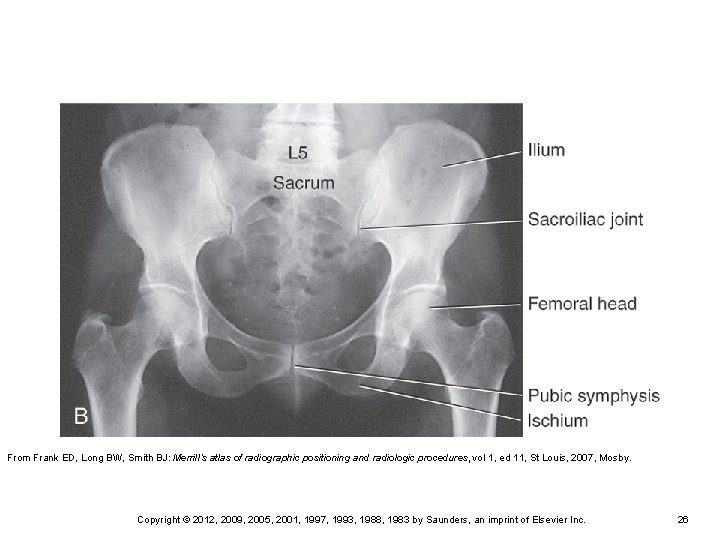 From Frank ED, Long BW, Smith BJ: Merrill’s atlas of radiographic positioning and radiologic From Frank ED, Long BW, Smith BJ: Merrill’s atlas of radiographic positioning and radiologic