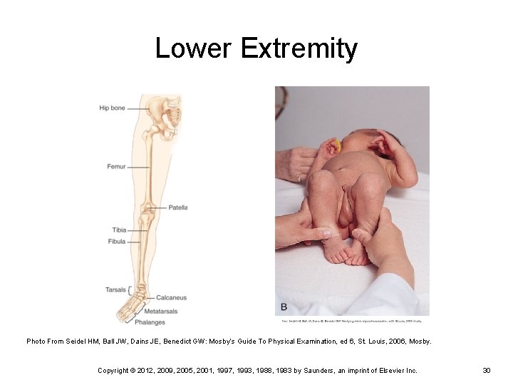 Lower Extremity Photo From Seidel HM, Ball JW, Dains JE, Benedict GW: Mosby’s Guide Lower Extremity Photo From Seidel HM, Ball JW, Dains JE, Benedict GW: Mosby’s Guide