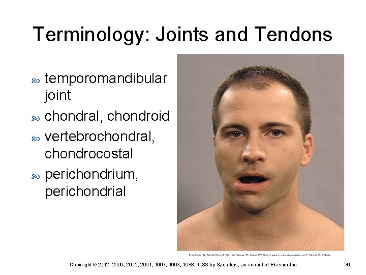 Terminology: Joints and Tendons temporomandibular joint chondral, chondroid vertebrochondral, chondrocostal perichondrium, perichondrial Copyright © Terminology: Joints and Tendons temporomandibular joint chondral, chondroid vertebrochondral, chondrocostal perichondrium, perichondrial Copyright ©