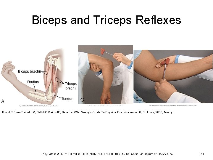 Biceps and Triceps Reflexes B and C From Seidel HM, Ball JW, Dains JE, Biceps and Triceps Reflexes B and C From Seidel HM, Ball JW, Dains JE,