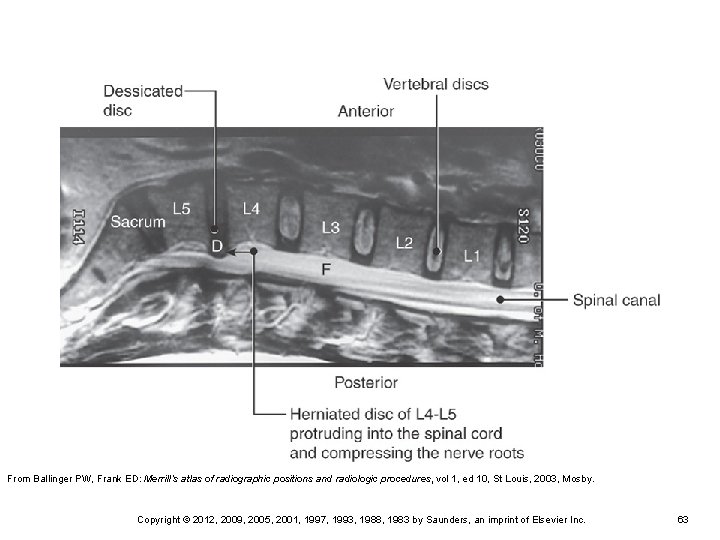 From Ballinger PW, Frank ED: Merrill’s atlas of radiographic positions and radiologic procedures, vol From Ballinger PW, Frank ED: Merrill’s atlas of radiographic positions and radiologic procedures, vol