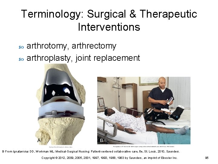 Terminology: Surgical & Therapeutic Interventions arthrotomy, arthrectomy arthroplasty, joint replacement B From Ignatavicius DD, Terminology: Surgical & Therapeutic Interventions arthrotomy, arthrectomy arthroplasty, joint replacement B From Ignatavicius DD,