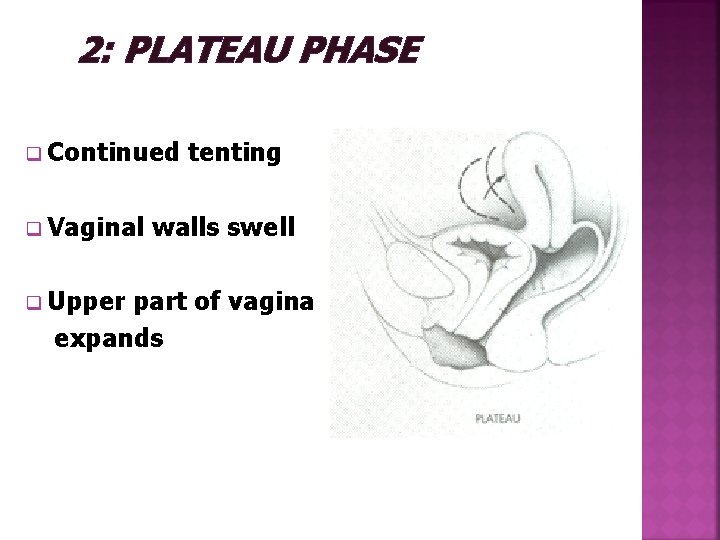  2: PLATEAU PHASE q Continued tenting q Vaginal walls swell q Upper part