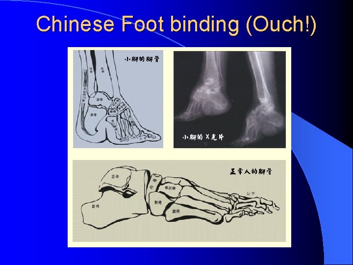 Chinese Foot binding (Ouch!) 