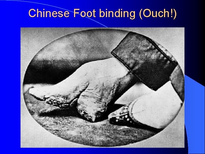 Chinese Foot binding (Ouch!) 