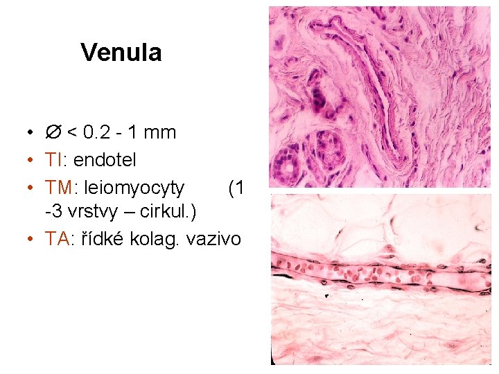 Venula • < 0. 2 - 1 mm • TI: endotel • TM: leiomyocyty