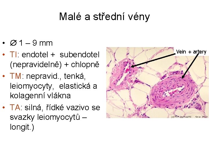 Malé a střední vény • 1 – 9 mm • TI: endotel + subendotel
