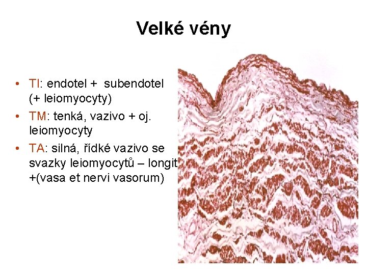 Velké vény • TI: endotel + subendotel (+ leiomyocyty) • TM: tenká, vazivo +