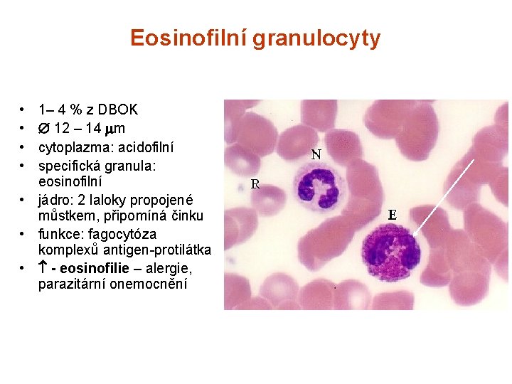 Eosinofilní granulocyty • • 1– 4 % z DBOK 12 – 14 m cytoplazma: