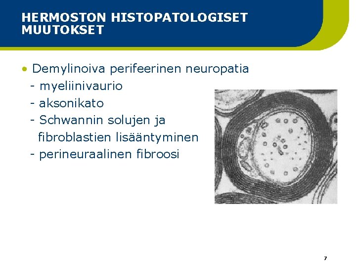 HERMOSTON HISTOPATOLOGISET MUUTOKSET • Demylinoiva perifeerinen neuropatia - myeliinivaurio - aksonikato - Schwannin solujen HERMOSTON HISTOPATOLOGISET MUUTOKSET • Demylinoiva perifeerinen neuropatia - myeliinivaurio - aksonikato - Schwannin solujen