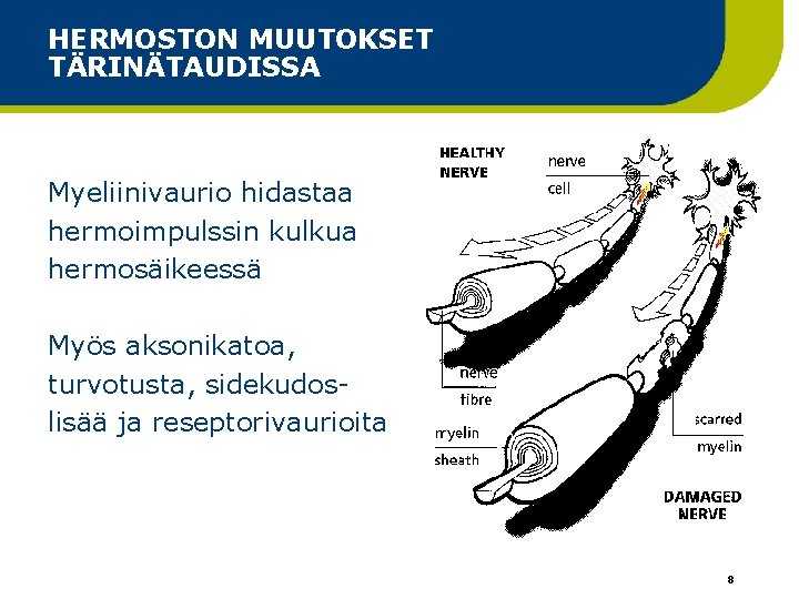 HERMOSTON MUUTOKSET TÄRINÄTAUDISSA Myeliinivaurio hidastaa hermoimpulssin kulkua hermosäikeessä Myös aksonikatoa, turvotusta, sidekudoslisää ja reseptorivaurioita HERMOSTON MUUTOKSET TÄRINÄTAUDISSA Myeliinivaurio hidastaa hermoimpulssin kulkua hermosäikeessä Myös aksonikatoa, turvotusta, sidekudoslisää ja reseptorivaurioita